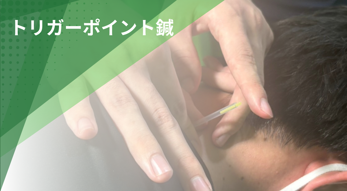 首や肩の筋肉のコリに対して行うトリガーポイント鍼施術